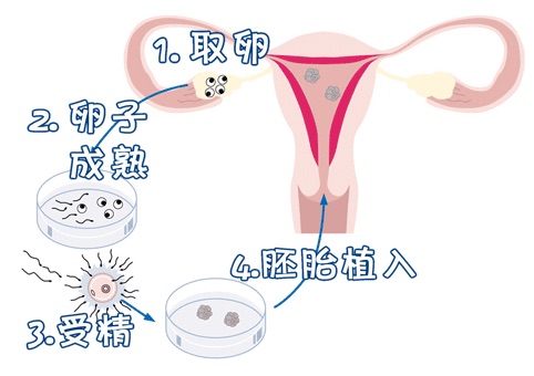 代怀选性别包生男孩